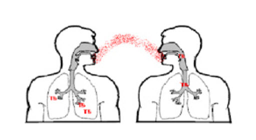 Tuberculosis (TB) Services