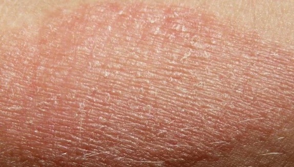 Is Your Water Destroying You Skin?