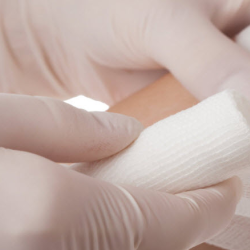 Advanced Wound Treatment and Therapies