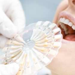 Teeth Whitening