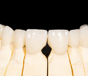 Zirconia and EMAX