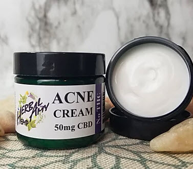 CBD Herbal Acne Cream