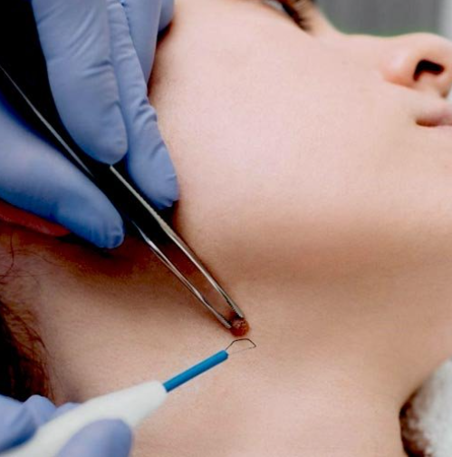 Surgical Dermatology