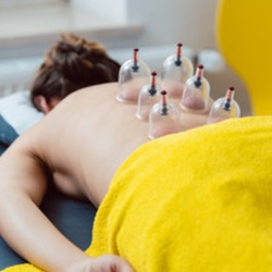 Cupping