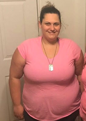 OBESITY & BARIATRIC SURGERY