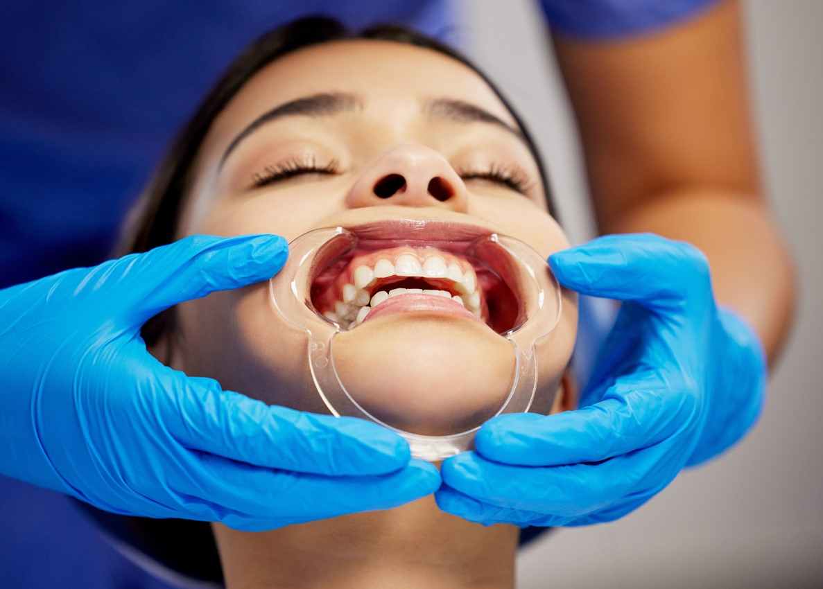 Invisalign