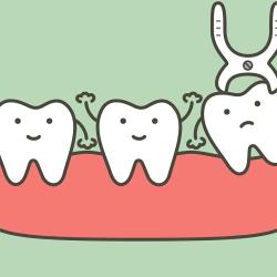 Extractions