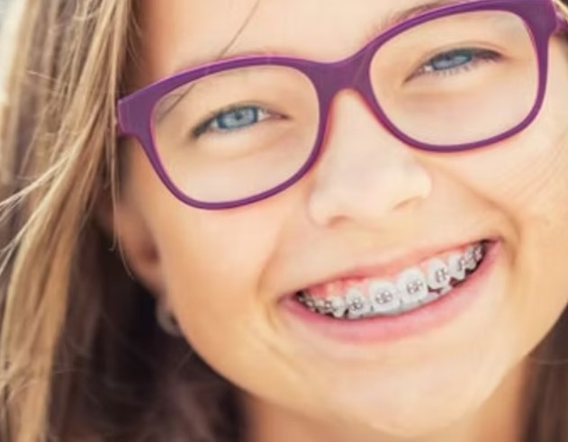 Traditional & Clear Braces
