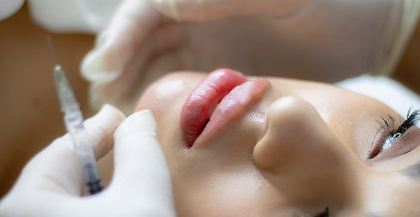 Dermal Filler Injectables