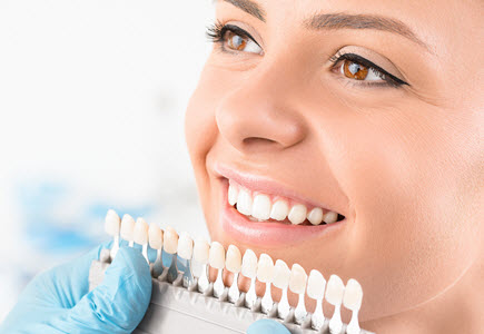 Veneers