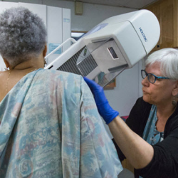 Breast and Ovarian Cancer Prevention