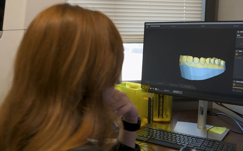 Same-Day Crowns & Bridges