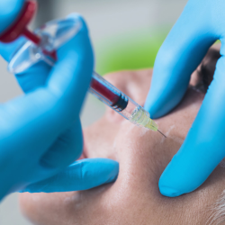 PRP (Platelet-Rich Plasma)