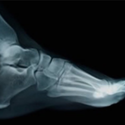 Digital X-Rays