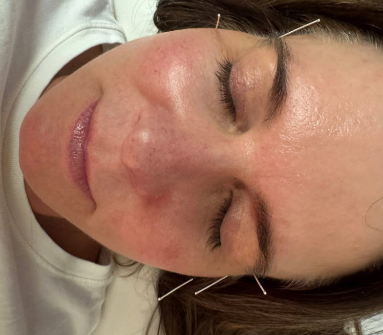 Facials