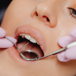Dental Cleanings