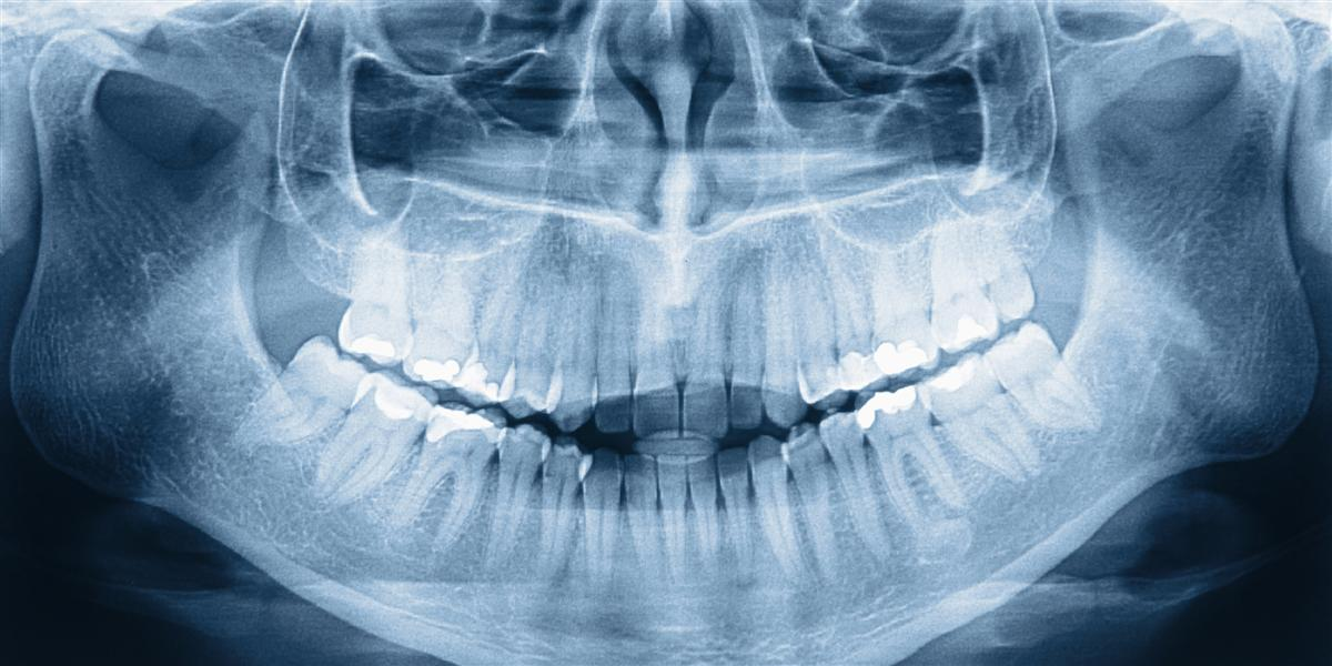 Dental Problems