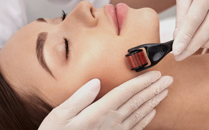 Clinical Microneedling