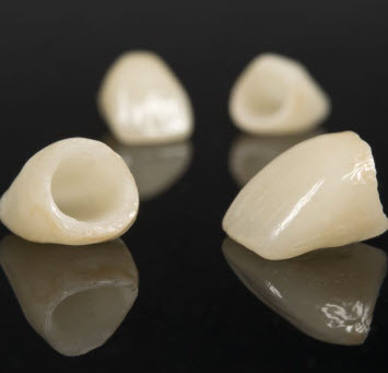 Crowns