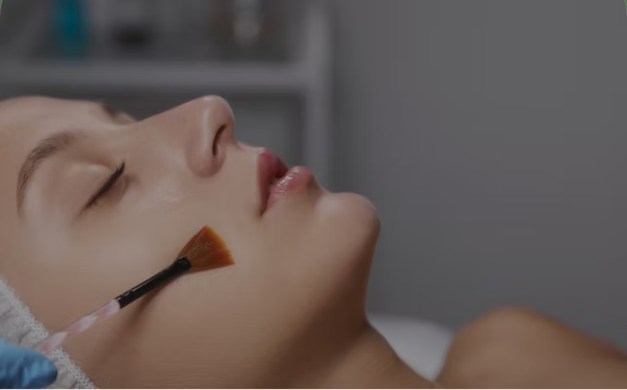 Chemical Peels