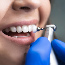 Dental Cleanings