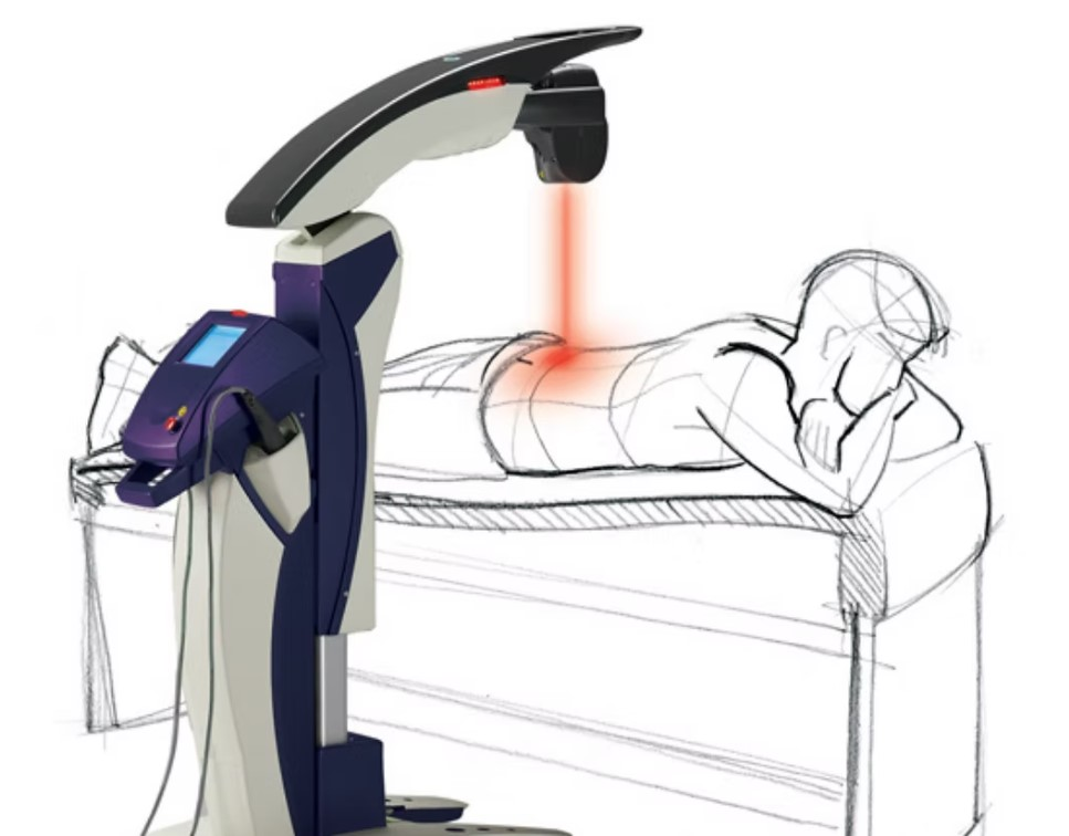 MLS Laser Therapy