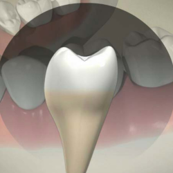 Sealants