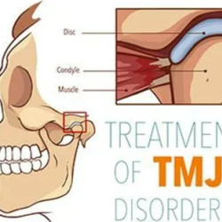 TMD
