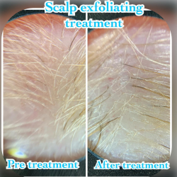 Treatments