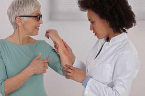 Contact Dermatitis