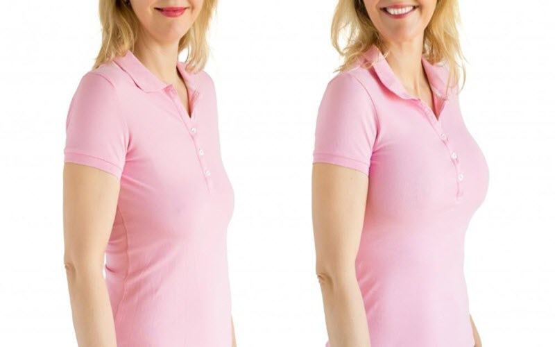Breast Enhancement