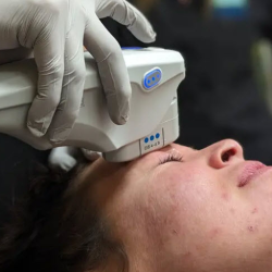 Ultherapy