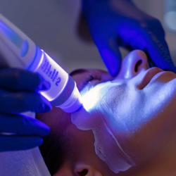 Laser Treatment