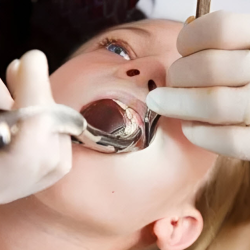 Extractions