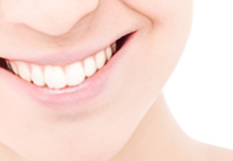 Teeth Whitening
