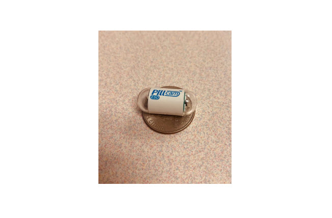 Video Capsule Endoscopy