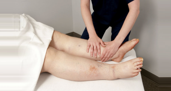 Lymphedema Therapy