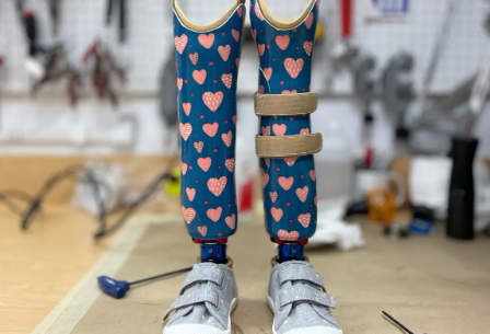 Upper and Lower Extremity Prosthetics