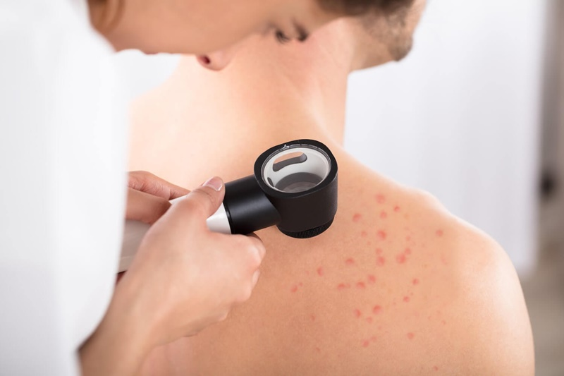 Medical Dermatology