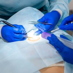 Surgical Dermatology
