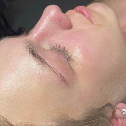 Facial