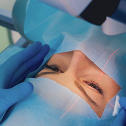 LASIK and Cataract Co-Management