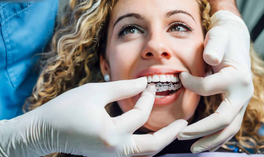 Invisalign