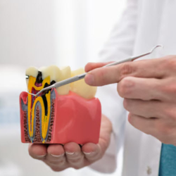 Root Canal Treatment