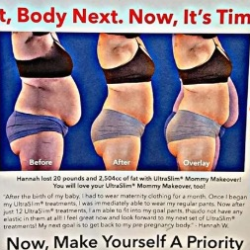 RED LIGHT WEIGHT LOSS THERAPY
