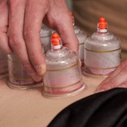 Cupping