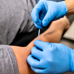 Dry Needling