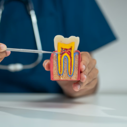 Root Canal Treatment