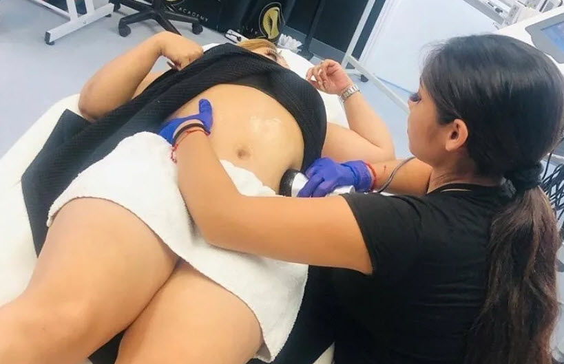 Ultrasound Cavitation