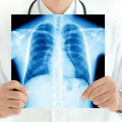 Digital X-Rays